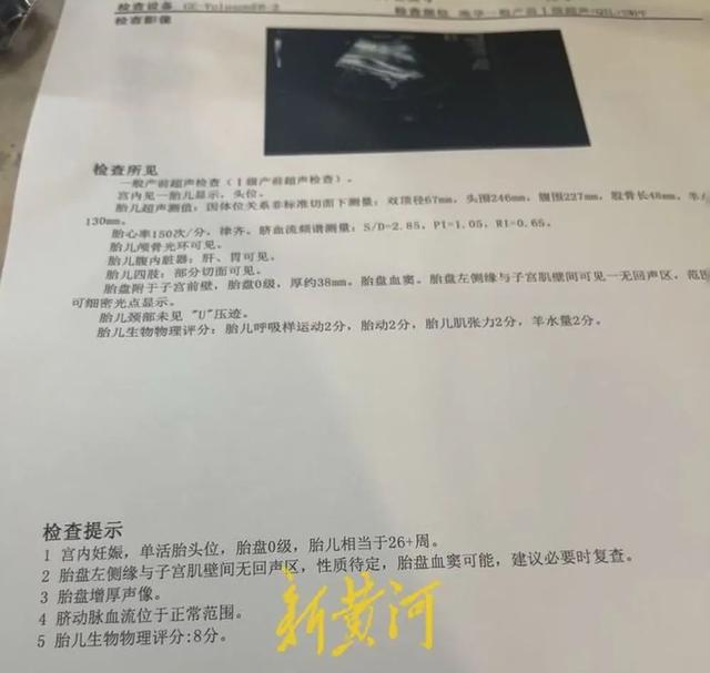 孕妇动车上被行李砸中致孩子早产离世，当事人：准备起诉